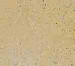 Cast stone bath acid etch